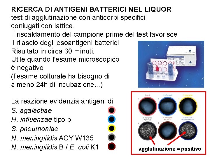 RICERCA DI ANTIGENI BATTERICI NEL LIQUOR test di agglutinazione con anticorpi specifici coniugati con