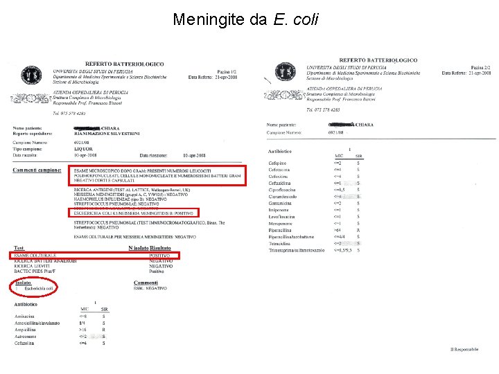 Meningite da E. coli 