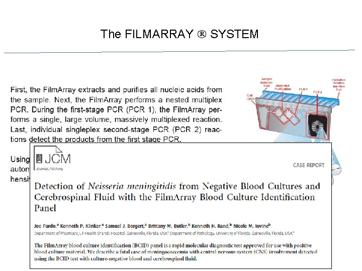 The FILMARRAY SYSTEM 