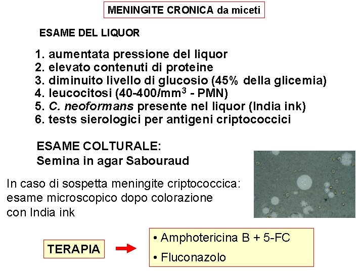 MENINGITE CRONICA da miceti ESAME DEL LIQUOR 1. aumentata pressione del liquor 2. elevato