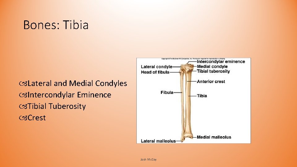 Bones: Tibia Lateral and Medial Condyles Intercondylar Eminence Tibial Tuberosity Crest Josh Mc. Coy Bones: Tibia Lateral and Medial Condyles Intercondylar Eminence Tibial Tuberosity Crest Josh Mc. Coy