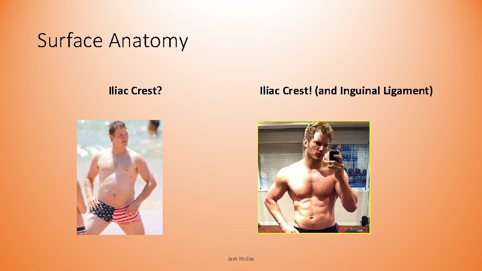 Surface Anatomy Iliac Crest? Iliac Crest! (and Inguinal Ligament) Josh Mc. Coy Surface Anatomy Iliac Crest? Iliac Crest! (and Inguinal Ligament) Josh Mc. Coy
