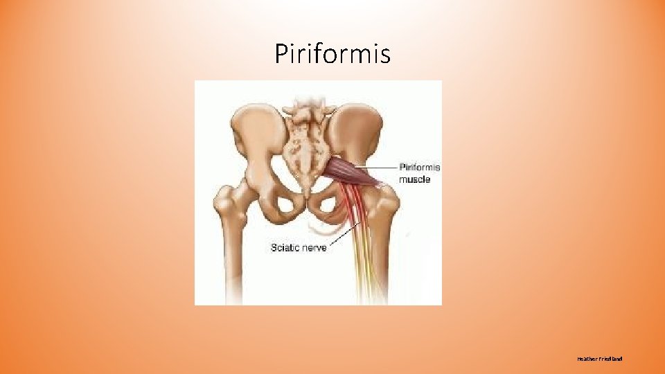 Piriformis Heather Friedland Piriformis Heather Friedland