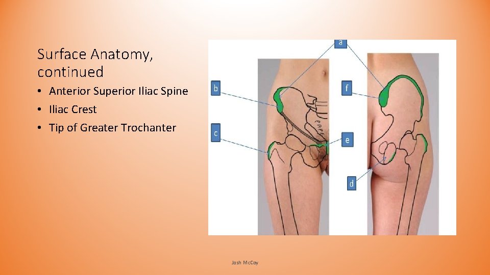Surface Anatomy, continued • Anterior Superior Iliac Spine • Iliac Crest • Tip of Surface Anatomy, continued • Anterior Superior Iliac Spine • Iliac Crest • Tip of