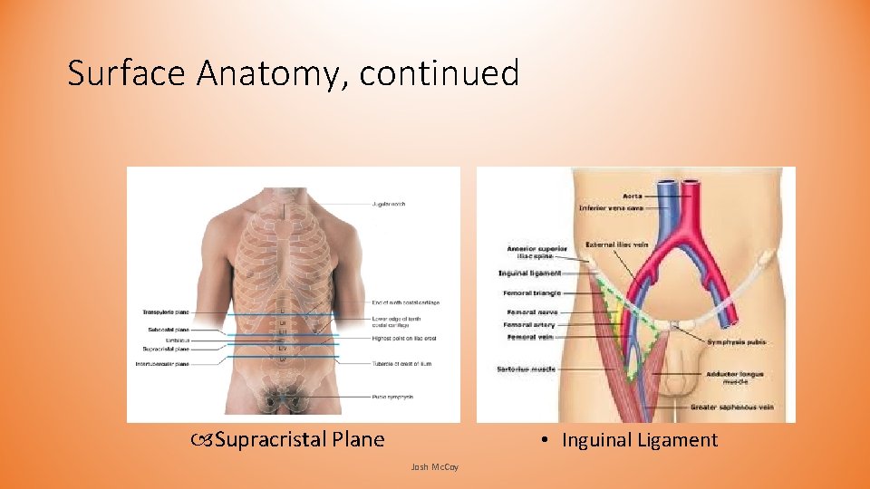 Surface Anatomy, continued Supracristal Plane • Inguinal Ligament Josh Mc. Coy Surface Anatomy, continued Supracristal Plane • Inguinal Ligament Josh Mc. Coy