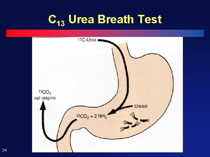C 13 Urea Breath Test 34 C 13 Urea Breath Test 34