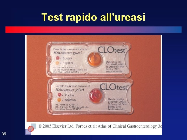 Test rapido all’ureasi 35 Test rapido all’ureasi 35