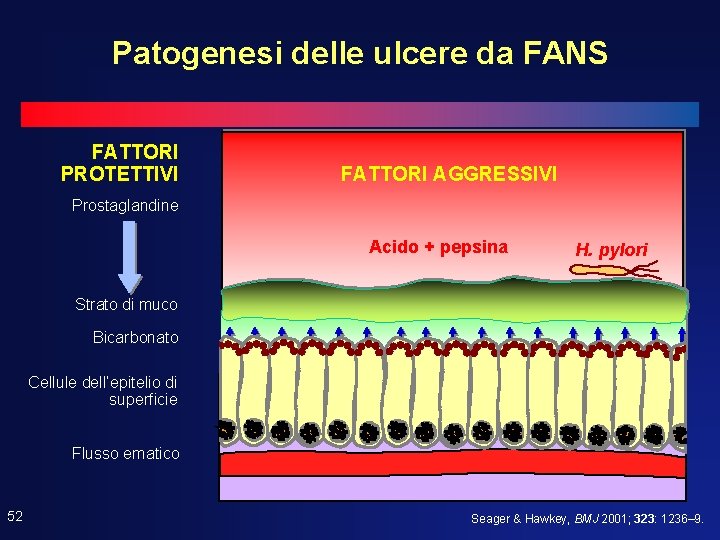 Patogenesi delle ulcere da FANS FATTORI PROTETTIVI FATTORI AGGRESSIVI Prostaglandine Acido + pepsina H. Patogenesi delle ulcere da FANS FATTORI PROTETTIVI FATTORI AGGRESSIVI Prostaglandine Acido + pepsina H.