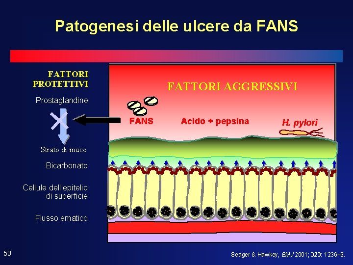 Patogenesi delle ulcere da FANS FATTORI PROTETTIVI + FATTORI AGGRESSIVI Prostaglandine FANS Acido + Patogenesi delle ulcere da FANS FATTORI PROTETTIVI + FATTORI AGGRESSIVI Prostaglandine FANS Acido +