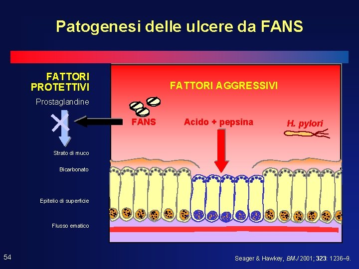 Patogenesi delle ulcere da FANS FATTORI PROTETTIVI + FATTORI AGGRESSIVI Prostaglandine FANS Acido + Patogenesi delle ulcere da FANS FATTORI PROTETTIVI + FATTORI AGGRESSIVI Prostaglandine FANS Acido +