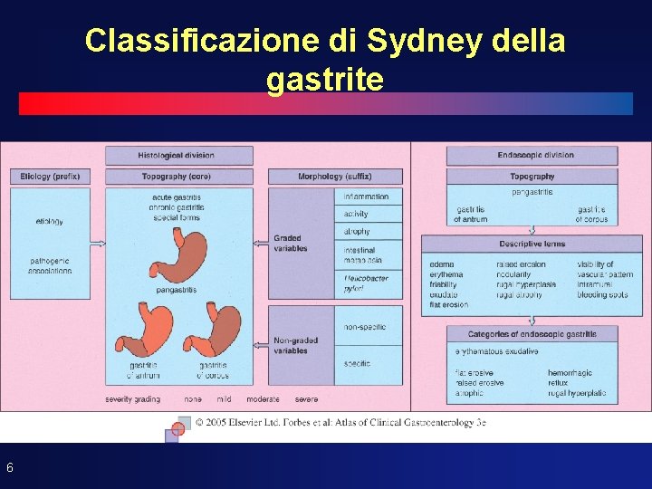 Classificazione di Sydney della gastrite 6 Classificazione di Sydney della gastrite 6