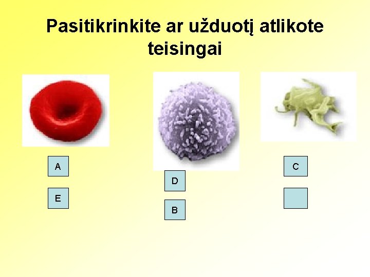 Pasitikrinkite ar užduotį atlikote teisingai A C D E B 