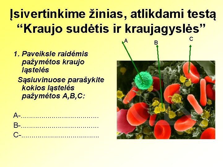Įsivertinkime žinias, atlikdami testą “Kraujo sudėtis ir kraujagyslės” A 1. Paveiksle raidėmis pažymėtos kraujo