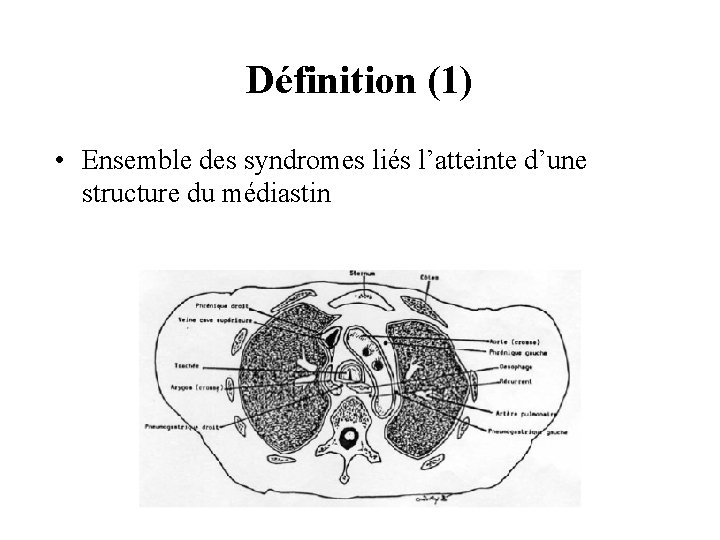 Définition (1) • Ensemble des syndromes liés l’atteinte d’une structure du médiastin 