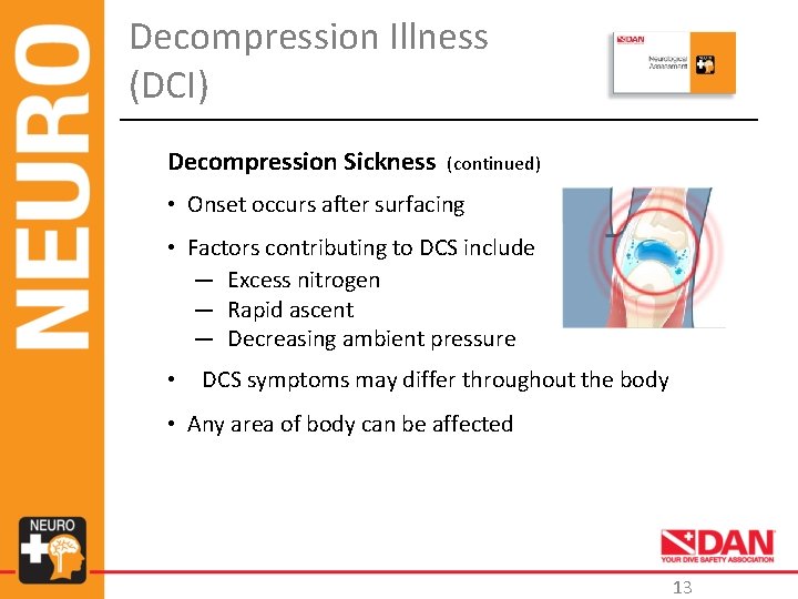 Decompression Illness (DCI) Decompression Sickness (continued) • Onset occurs after surfacing • Factors contributing