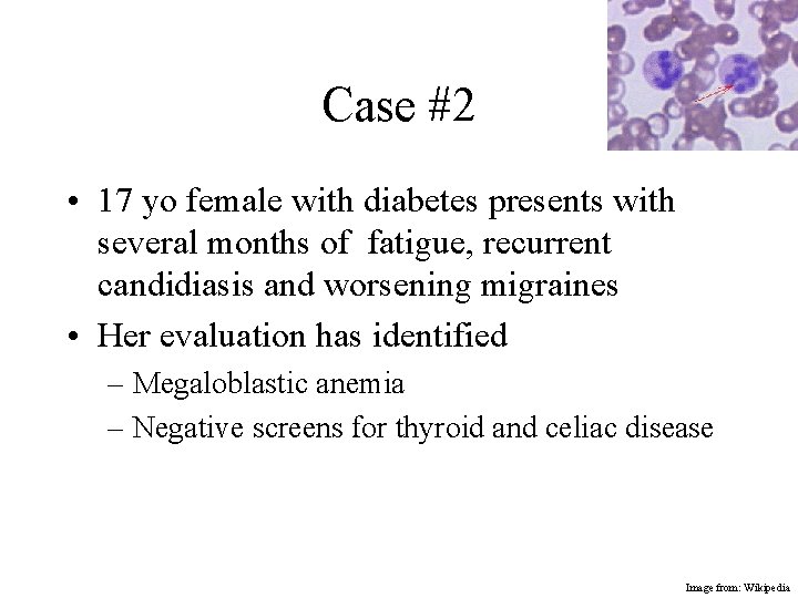 Case #2 • 17 yo female with diabetes presents with several months of fatigue,