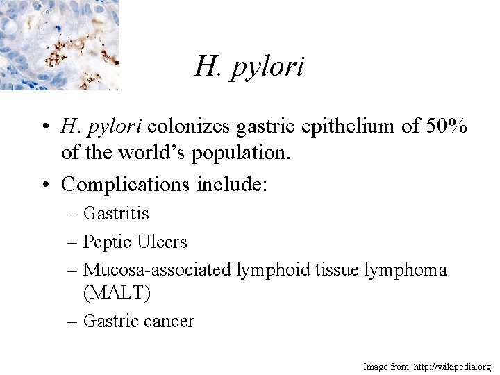 H. pylori • H. pylori colonizes gastric epithelium of 50% of the world’s population.