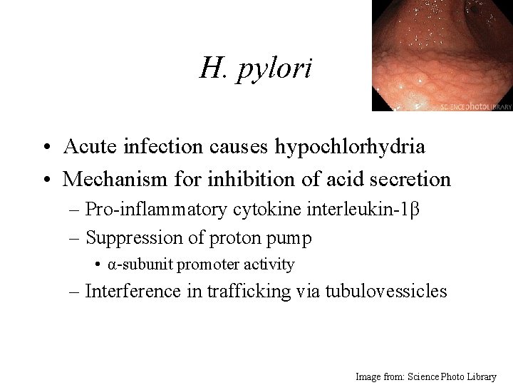 H. pylori • Acute infection causes hypochlorhydria • Mechanism for inhibition of acid secretion