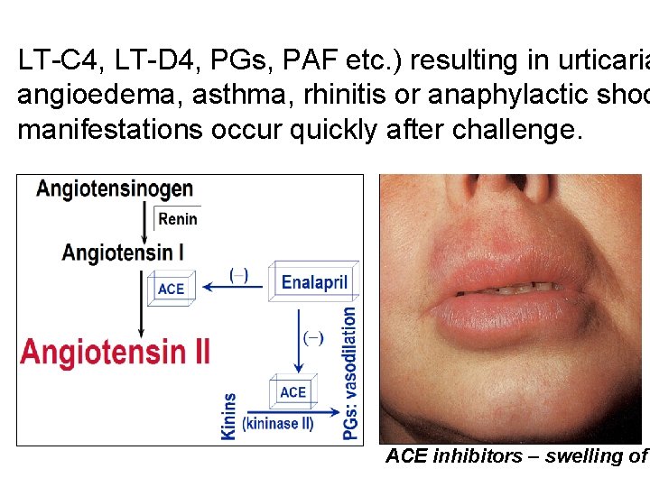 LT-C 4, LT-D 4, PGs, PAF etc. ) resulting in urticaria angioedema, asthma, rhinitis