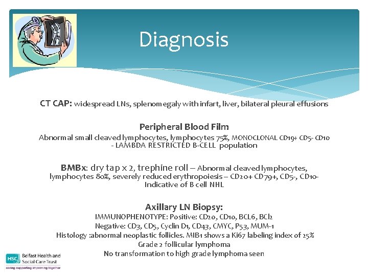 Diagnosis CT CAP: widespread LNs, splenomegaly with infart, liver, bilateral pleural effusions Peripheral Blood