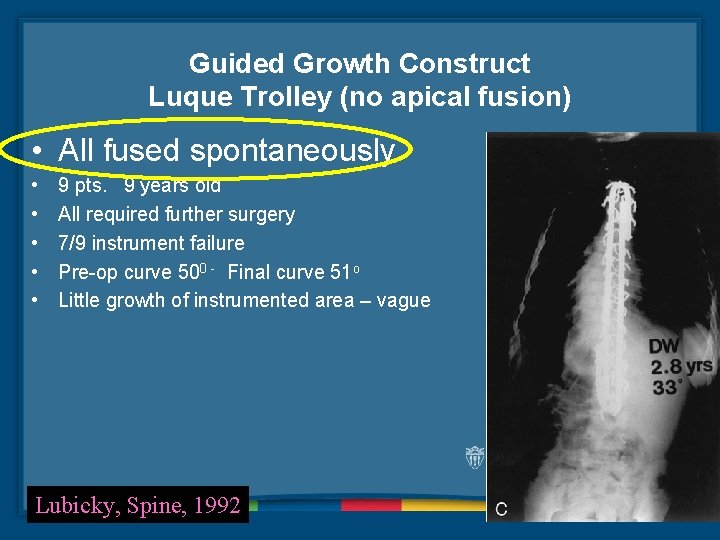 Guided Growth Construct Luque Trolley (no apical fusion) • All fused spontaneously • •