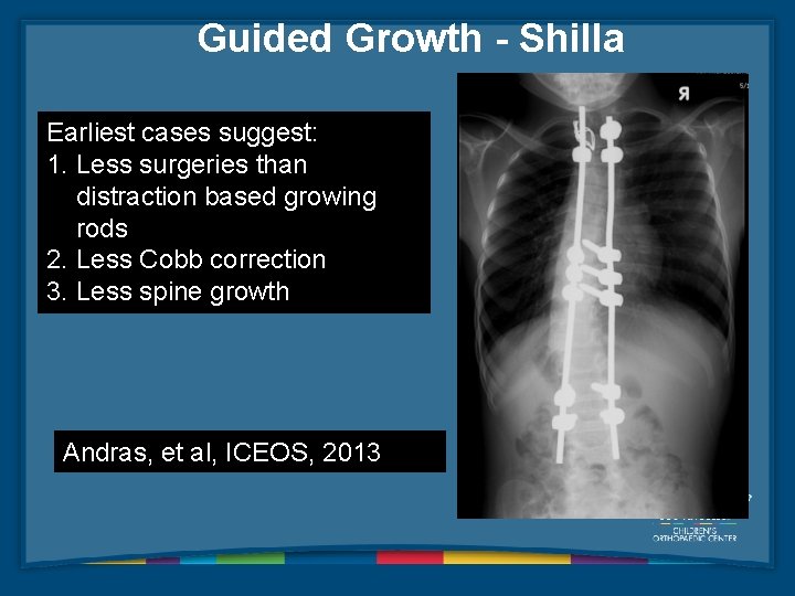Guided Growth - Shilla Earliest cases suggest: 1. Less surgeries than distraction based growing