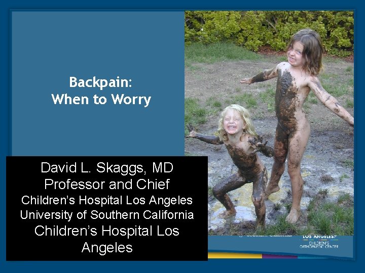 Backpain: When to Worry David L. Skaggs, MD Professor and Chief Children’s Hospital Los