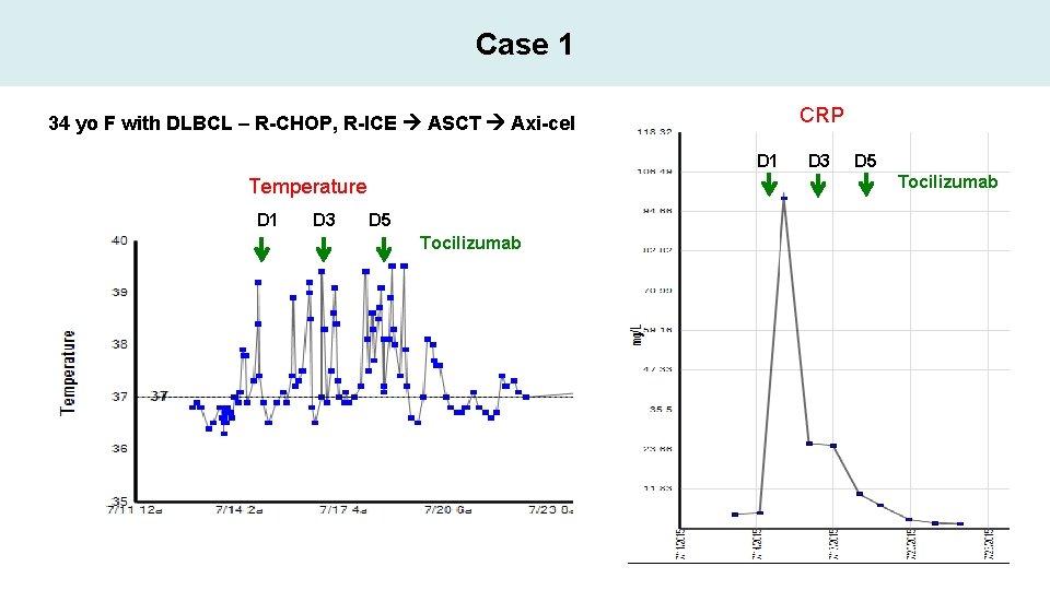 Case 1 CRP 34 yo F with DLBCL – R-CHOP, R-ICE ASCT Axi-cel D