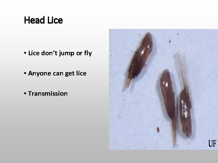 Head Lice • Lice don’t jump or fly • Anyone can get lice •