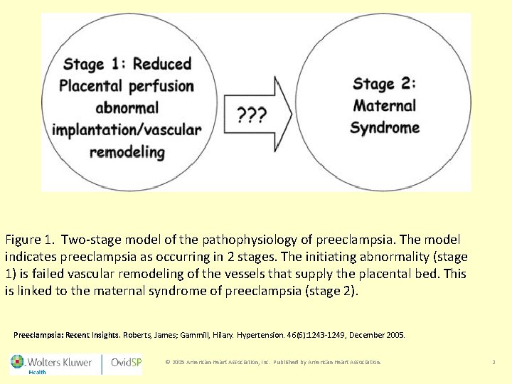 Figure 1. Two-stage model of the pathophysiology of preeclampsia. The model indicates preeclampsia as