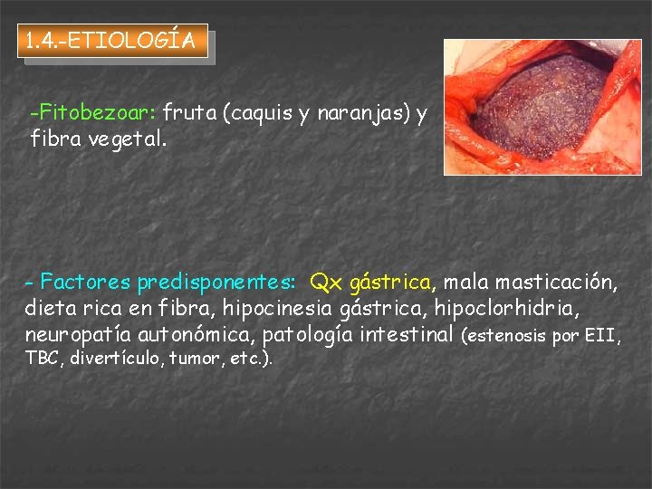 1. 4. -ETIOLOGÍA -Fitobezoar: fruta (caquis y naranjas) y fibra vegetal. - Factores predisponentes: