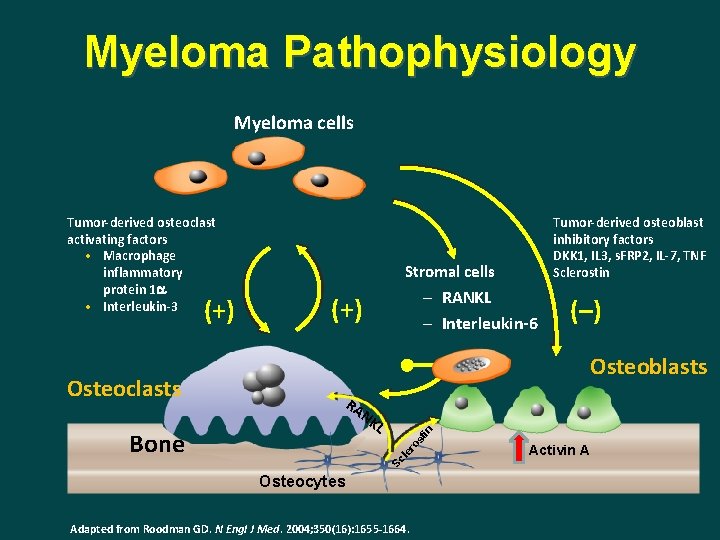 Myeloma Pathophysiology Myeloma cells (–) Osteoblasts RA NK in L st Bone (+) ro