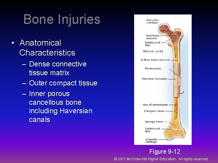 Bone Injuries • Anatomical Characteristics – Dense connective tissue matrix – Outer compact tissue