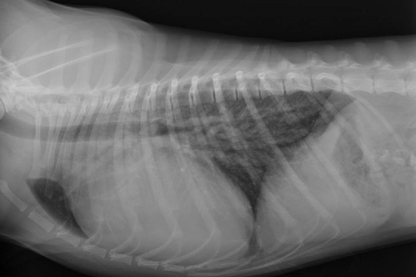 Persistierender Ductus arteriosus PDA Sonographie 