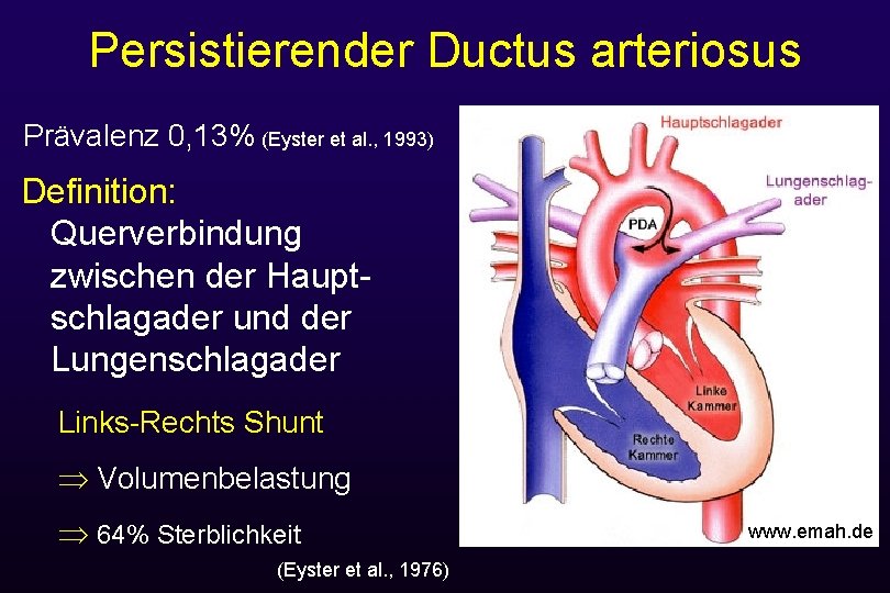 Persistierender Ductus arteriosus Prävalenz 0, 13% (Eyster et al. , 1993) Definition: Querverbindung zwischen