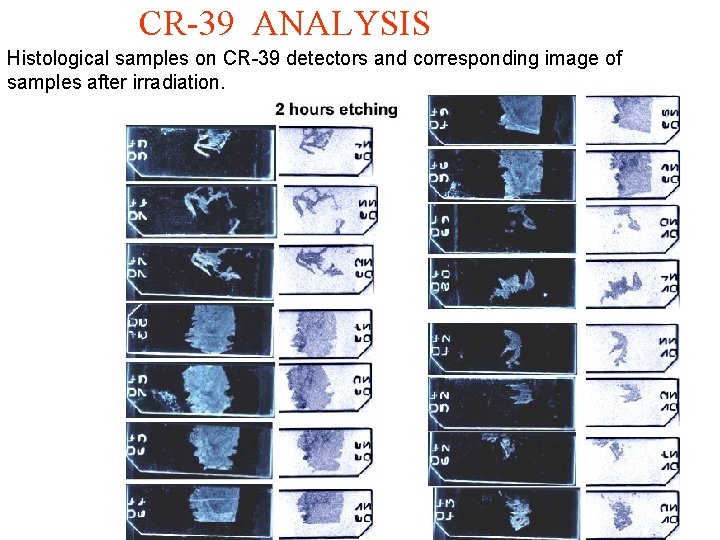 CR-39 ANALYSIS Histological samples on CR-39 detectors and corresponding image of samples after irradiation.
