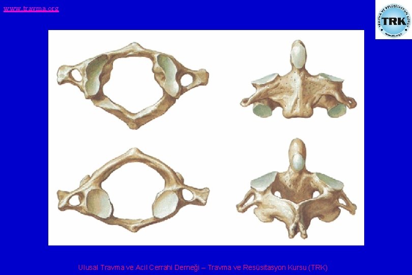 www. travma. org Ulusal Travma ve Acil Cerrahi Derneği – Travma ve Resüsitasyon Kursu