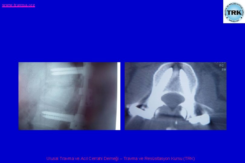 www. travma. org Ulusal Travma ve Acil Cerrahi Derneği – Travma ve Resüsitasyon Kursu