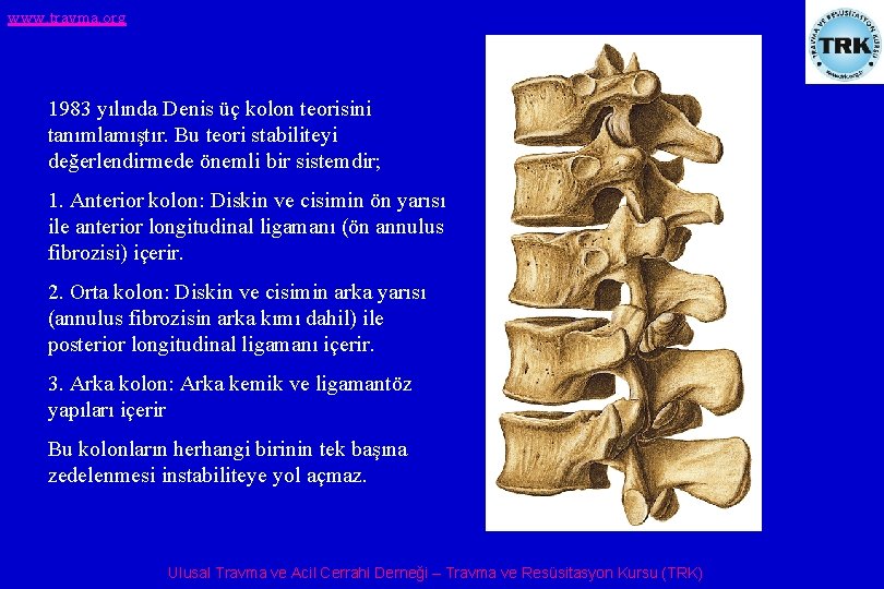www. travma. org 1983 yılında Denis üç kolon teorisini tanımlamıştır. Bu teori stabiliteyi değerlendirmede