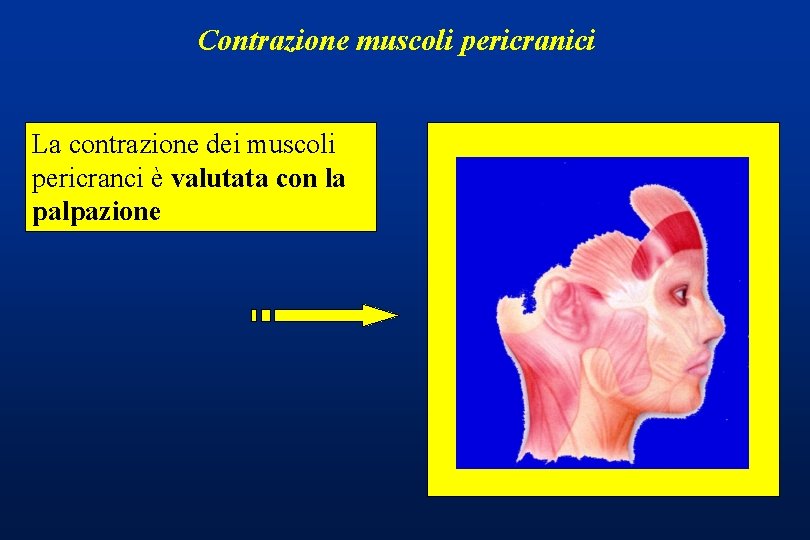 Contrazione muscoli pericranici La contrazione dei muscoli pericranci è valutata con la palpazione 