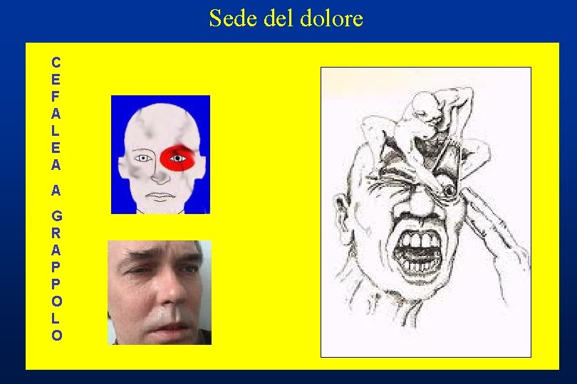 Sede del dolore EC ME I F CA RL E AA N A I