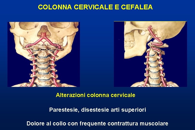 COLONNA CERVICALE E CEFALEA Alterazioni colonna cervicale Parestesie, disestesie arti superiori Dolore al collo