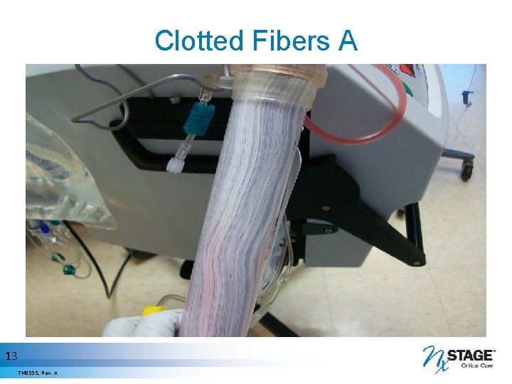 Clotted Fibers A 13 TM 0555, Rev. A 