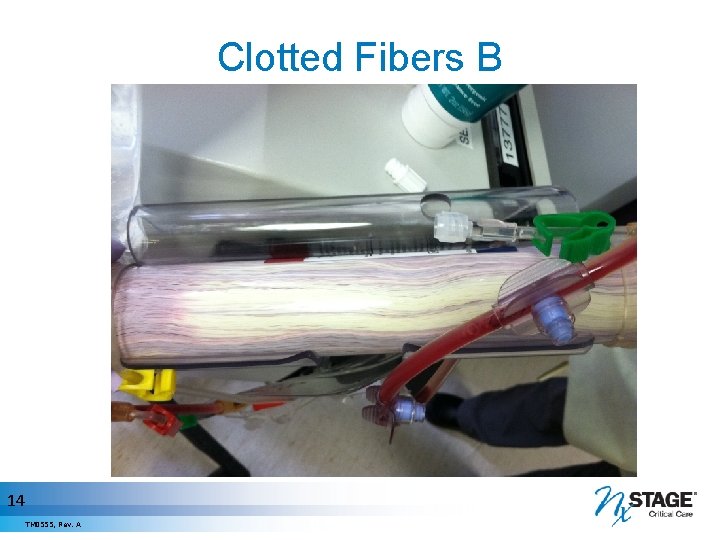 Clotted Fibers B 14 TM 0555, Rev. A 