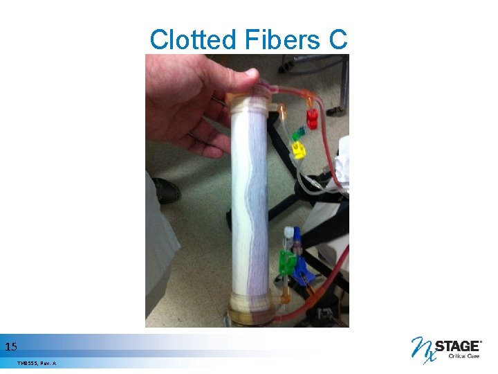 Clotted Fibers C 15 TM 0555, Rev. A 