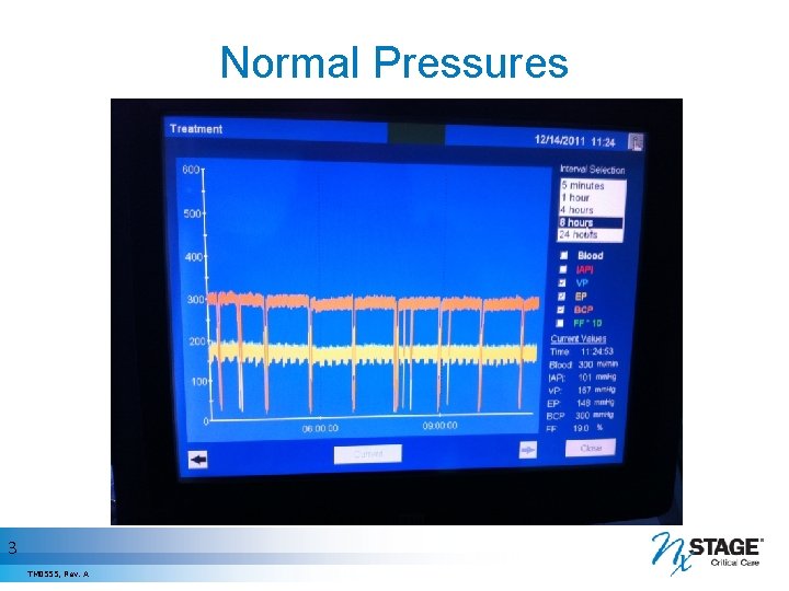 Normal Pressures 3 TM 0555, Rev. A 