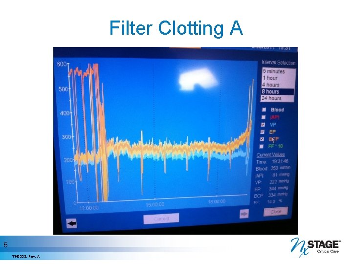 Filter Clotting A 6 TM 0555, Rev. A 