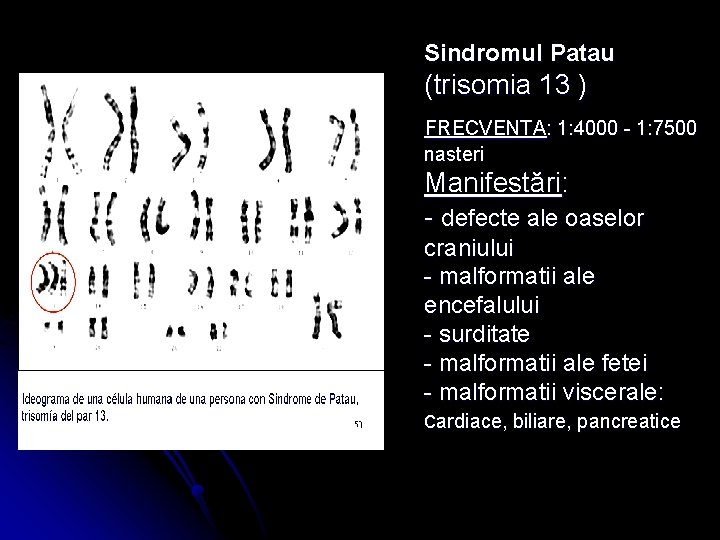 Sindromul Patau (trisomia 13 ) FRECVENTA: 1: 4000 - 1: 7500 nasteri Manifestări: -