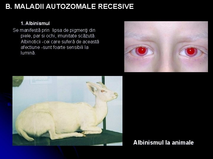 B. MALADII AUTOZOMALE RECESIVE 1. Albinismul Se manifestă prin lipsa de pigmenţi din piele,
