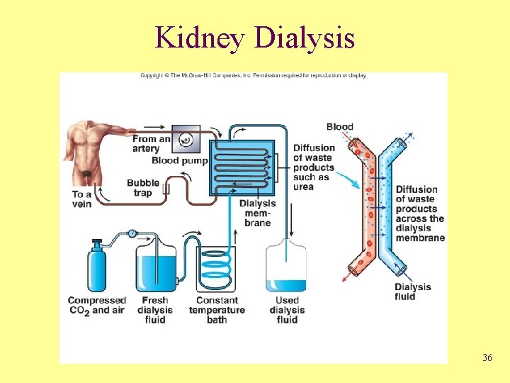 Kidney Dialysis 36 
